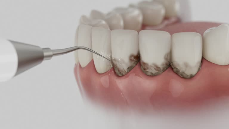 Trusted Dental Crowns And Bridges service in Mecca, CA - Dentist Open Now